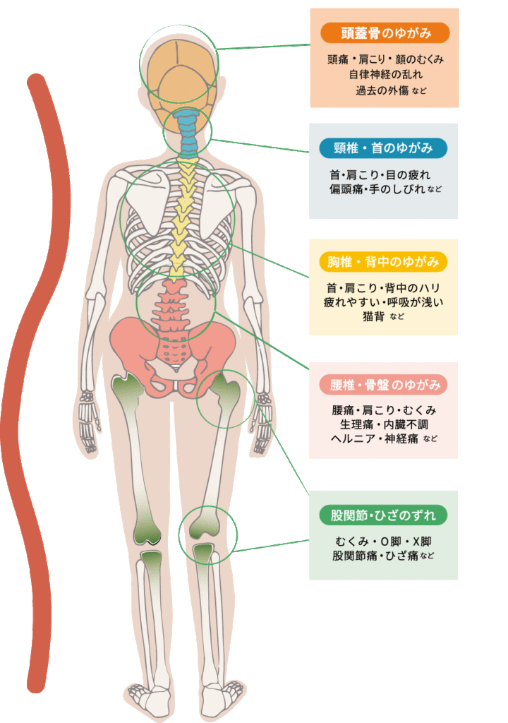 深澤治療室|根本原因|全身の骨のゆがみ